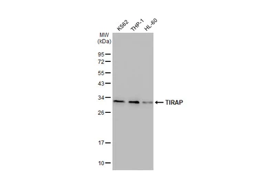 Anti-TIRAP antibody [GT1343] used in Western Blot (WB). GTX03255