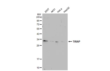 Anti-TIRAP antibody [GT1343] used in Western Blot (WB). GTX03255