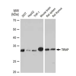 Anti-TIRAP antibody [GT1343] used in Western Blot (WB). GTX03255