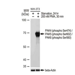 Anti-PAK4 (phospho Ser474) / PAK5 (phospho Ser602) / PAK6 (phospho Ser560) antibody [GT1344] used in Western Blot (WB). GTX03256