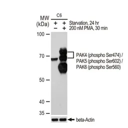 Anti-PAK4 (phospho Ser474) / PAK5 (phospho Ser602) / PAK6 (phospho Ser560) antibody [GT1344] used in Western Blot (WB). GTX03256