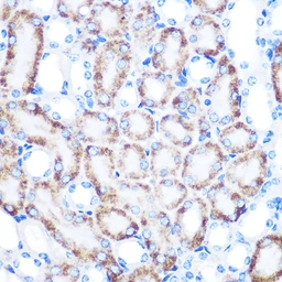 Anti-CD168 / RHAMM antibody [GT1346] used in IHC (Paraffin sections) (IHC-P). GTX03261