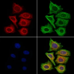 Anti-Filaggrin antibody used in Immunocytochemistry/ Immunofluorescence (ICC/IF). GTX03270