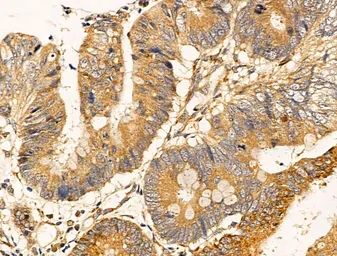 Anti-Filaggrin antibody used in IHC (Paraffin sections) (IHC-P). GTX03270
