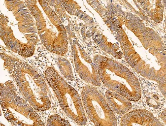 Anti-Filaggrin antibody used in IHC (Paraffin sections) (IHC-P). GTX03270