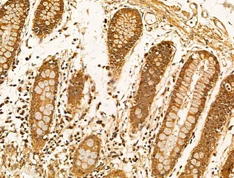 Anti-Filaggrin antibody used in IHC (Paraffin sections) (IHC-P). GTX03270