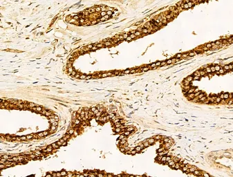 Anti-Filaggrin antibody used in IHC (Paraffin sections) (IHC-P). GTX03270