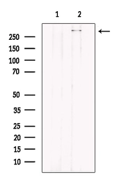 Anti-Filaggrin antibody used in Western Blot (WB). GTX03270