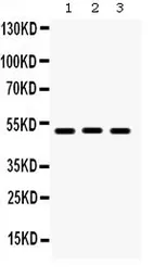 Anti-BMP5 antibody used in Western Blot (WB). GTX03273