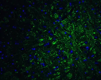 Anti-PRDM16 antibody used in IHC (Paraffin sections) (IHC-P). GTX03275