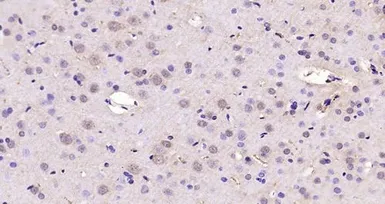 Anti-SREBP1 + SREBP2 antibody used in IHC (Paraffin sections) (IHC-P). GTX03277