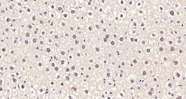 Anti-SREBP1 + SREBP2 antibody used in IHC (Paraffin sections) (IHC-P). GTX03277