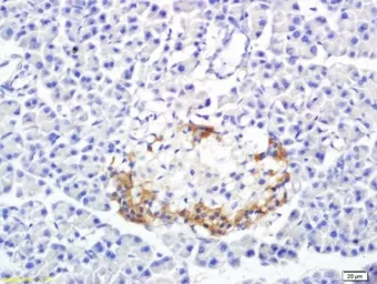 Anti-SREBP1 + SREBP2 antibody used in IHC (Paraffin sections) (IHC-P). GTX03277