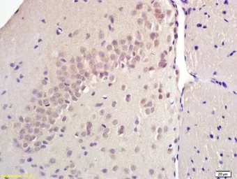 Anti-SREBP1 + SREBP2 antibody used in IHC (Paraffin sections) (IHC-P). GTX03277