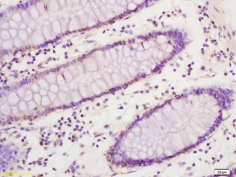 Anti-SREBP1 + SREBP2 antibody used in IHC (Paraffin sections) (IHC-P). GTX03277