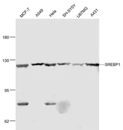 Anti-SREBP1 + SREBP2 antibody used in Western Blot (WB). GTX03277