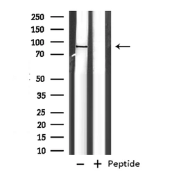 Anti-EXT1 antibody used in Western Blot (WB). GTX03280