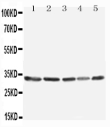 Anti-TNFAIP8L3 antibody used in Western Blot (WB). GTX03283