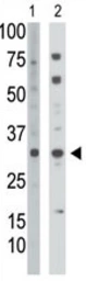 Anti-Thymidine Kinase 2 antibody used in Western Blot (WB). GTX03284
