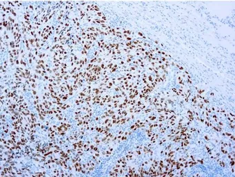 Anti-SOX10 antibody [20B7] used in IHC (Paraffin sections) (IHC-P). GTX03294