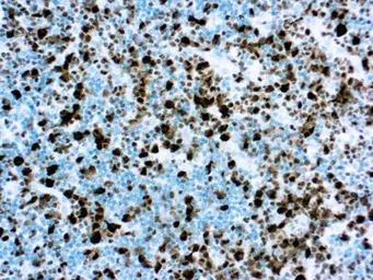 Anti-ALK antibody [4A4] used in IHC (Paraffin sections) (IHC-P). GTX03298