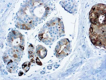 Anti-GCDFP15 antibody [DBM15.52] used in IHC (Paraffin sections) (IHC-P). GTX03303