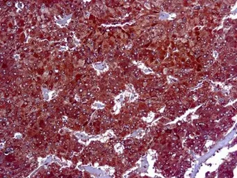 Anti-ADFP antibody [DBM15.60] used in IHC (Paraffin sections) (IHC-P). GTX03304