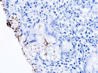 Anti-Helicobacter pylori 54kDa (flagellin) antibody [DBM15.75] used in IHC (Paraffin sections) (IHC-P). GTX03306