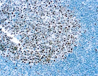 Anti-MSH2 antibody [DBM15.82] used in IHC (Paraffin sections) (IHC-P). GTX03307