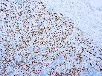 Anti-SOX10 antibody [EP268] used in IHC (Paraffin sections) (IHC-P). GTX03312