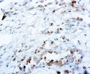Anti-ROS antibody [EPMGHR2] used in IHC (Paraffin sections) (IHC-P). GTX03313