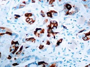 Anti-Mammaglobin A antibody [EPR 9092] used in IHC (Paraffin sections) (IHC-P). GTX03314
