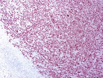 Anti-PRAME antibody [EPR20330] used in IHC (Paraffin sections) (IHC-P). GTX03315