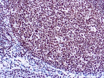 Anti-Ku70 antibody [H-6] used in IHC (Paraffin sections) (IHC-P). GTX03316