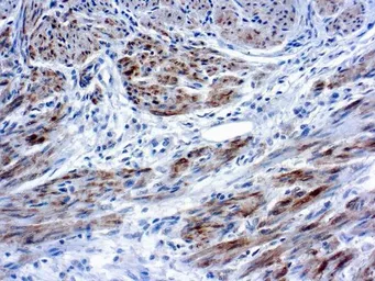 Anti-Caldesmon antibody [hHCD] used in IHC (Paraffin sections) (IHC-P). GTX03317