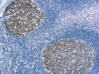 Anti-BCL6 antibody [PG-B6] used in IHC (Paraffin sections) (IHC-P). GTX03321