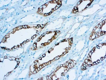 Anti-Renal Cell Carcinoma antibody [PN-15] used in IHC (Paraffin sections) (IHC-P). GTX03322