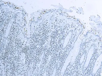 Anti-Helicobacter pylori antibody used in IHC (Paraffin sections) (IHC-P). GTX03330