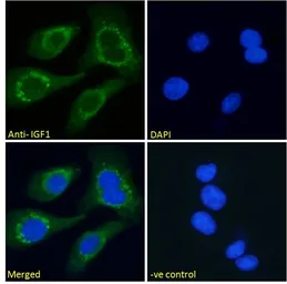 Anti-IGF1 antibody used in Immunocytochemistry/ Immunofluorescence (ICC/IF). GTX03348