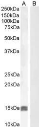 Anti-IGF1 antibody used in Western Blot (WB). GTX03348