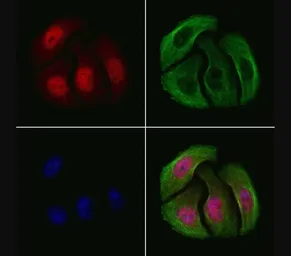 Anti-Chk2 (phospho Thr68) antibody used in Immunocytochemistry/ Immunofluorescence (ICC/IF). GTX03351