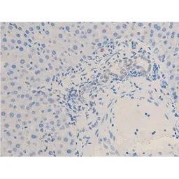 Anti-Chk2 (phospho Thr68) antibody used in IHC (Paraffin sections) (IHC-P). GTX03351