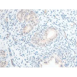 Anti-Chk2 (phospho Thr68) antibody used in IHC (Paraffin sections) (IHC-P). GTX03351