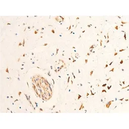 Anti-Chk2 (phospho Thr68) antibody used in IHC (Paraffin sections) (IHC-P). GTX03351
