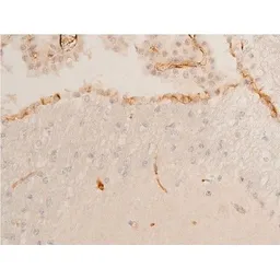 Anti-Chk2 (phospho Thr68) antibody used in IHC (Paraffin sections) (IHC-P). GTX03351