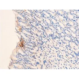Anti-Chk2 (phospho Thr68) antibody used in IHC (Paraffin sections) (IHC-P). GTX03351