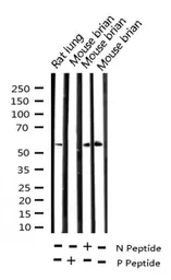 Anti-Chk2 (phospho Thr68) antibody used in Western Blot (WB). GTX03351