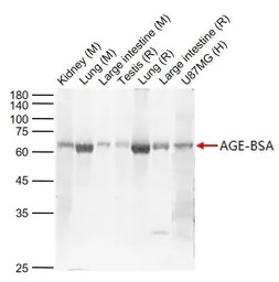 Anti-AGEs antibody used in Western Blot (WB). GTX03353