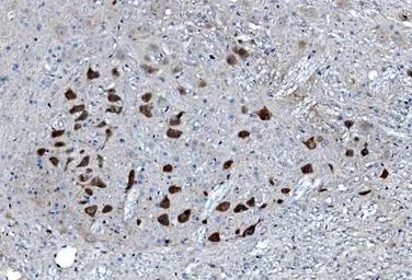 Anti-MAP3K8 antibody used in IHC (Paraffin sections) (IHC-P). GTX03357