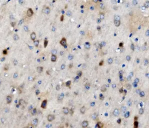Anti-MAP3K8 antibody used in IHC (Paraffin sections) (IHC-P). GTX03357